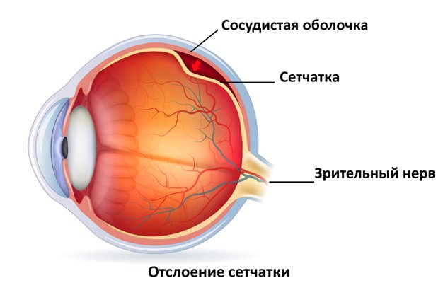Диагностика зрения при беременности